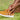 What Can Cause Bunions? Ask a Podiatrist